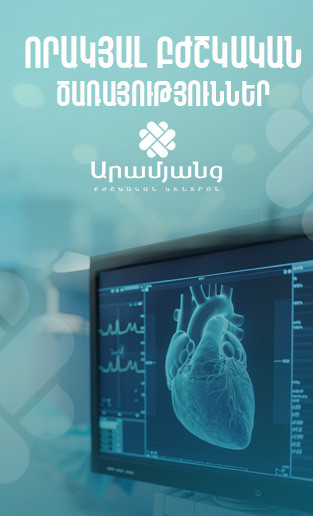 Գովազդ